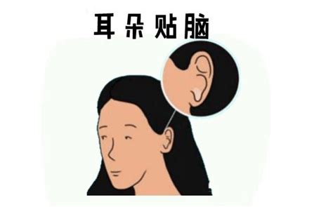 耳朵貼腦的女人